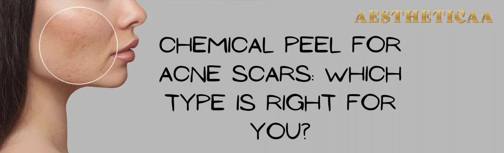 chemical peel treatment in bangalore