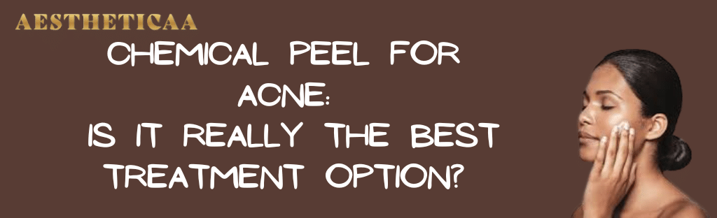 Chemical peel for acne